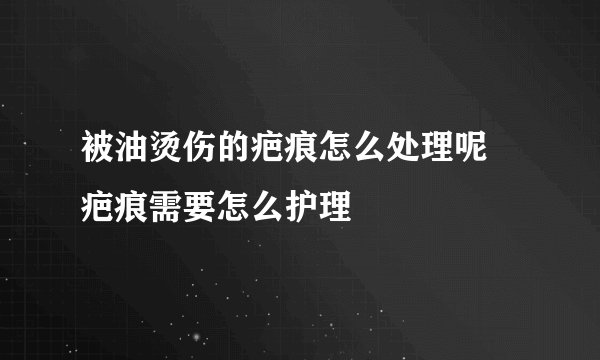 被油烫伤的疤痕怎么处理呢 疤痕需要怎么护理
