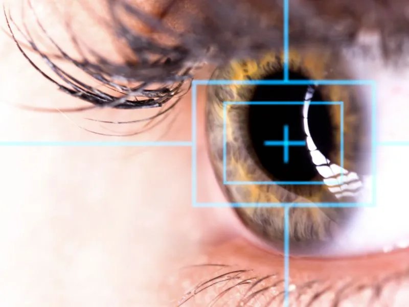 ok镜的佩戴及利弊