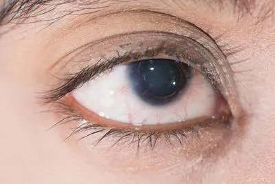 眼科检查一般多少钱呢