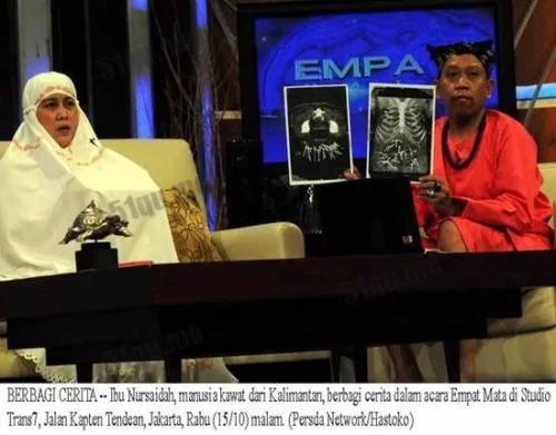 人称外星物种钢丝女努西达身体长钢丝图片 特异功能人的真实事件