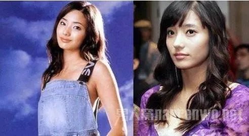 韩彩英整容前后：女神韩彩英整容前后对比照