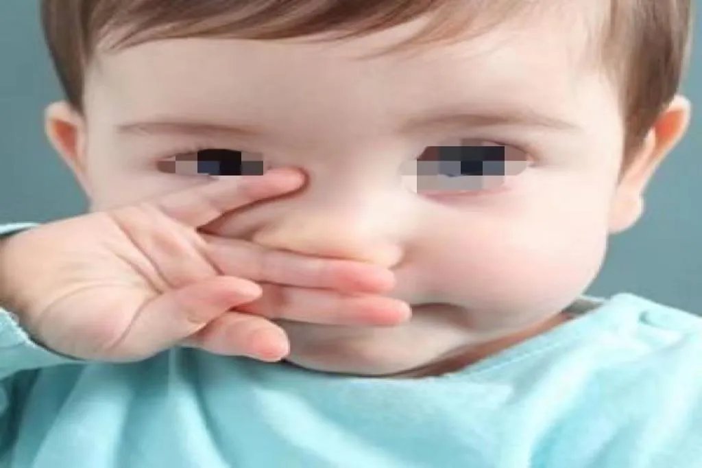 小孩鼻息肉图片