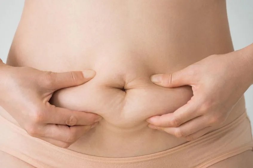 腰腹吸脂凹凸不平图片