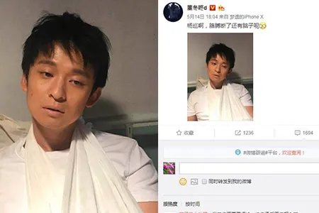 董子健晒照遭调侃 微博秀剧照扎绑带很憔悴