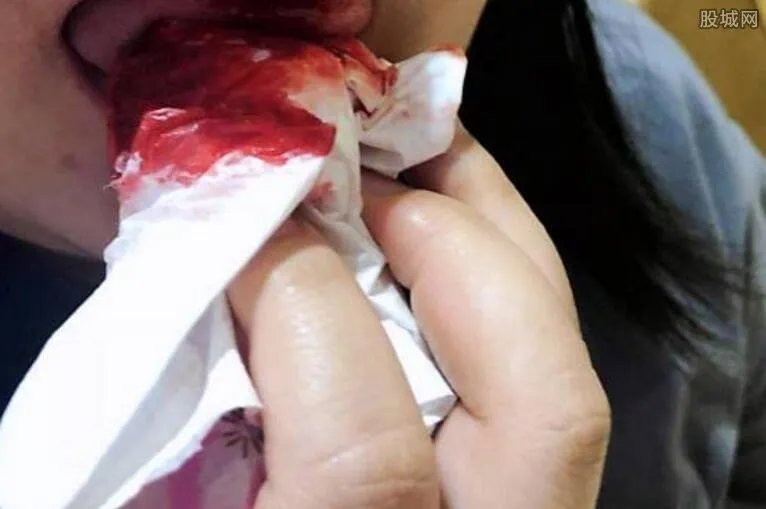 哈根达斯吃出玻璃 顾客口腔被严重割伤哈根达斯摊上事