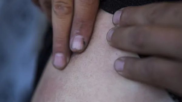 女生军训被马蜂爬嘴一动不动,遇到这种情况该怎么办?