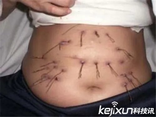 人称外星物种钢丝女努西达身体长钢丝图片 特异功能人的真实事件