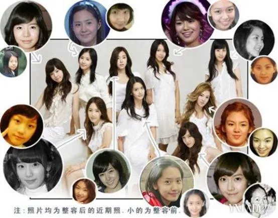 少女时代整容前后照片对比 少女时代为什么叫女帝