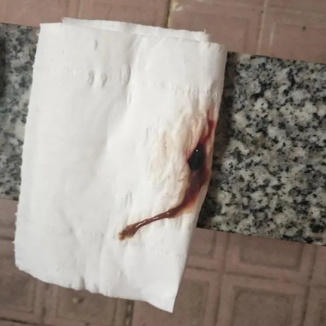 下面流黑色的脏东西图片