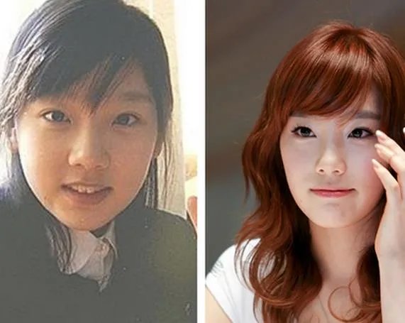 金泰妍整容前照片眼睛无神 与边伯贤车内激吻恋情曝光