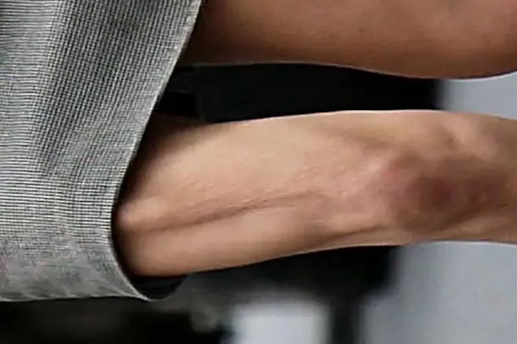 肚子有蛔虫是什么样子的症状