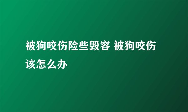 被狗咬伤险些毁容 被狗咬伤该怎么办