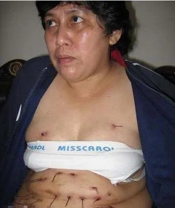 人称外星物种钢丝女努西达身体长钢丝图片 特异功能人的真实事件