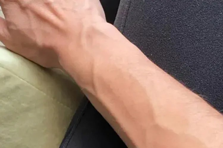 女性胳膊血管明显图片