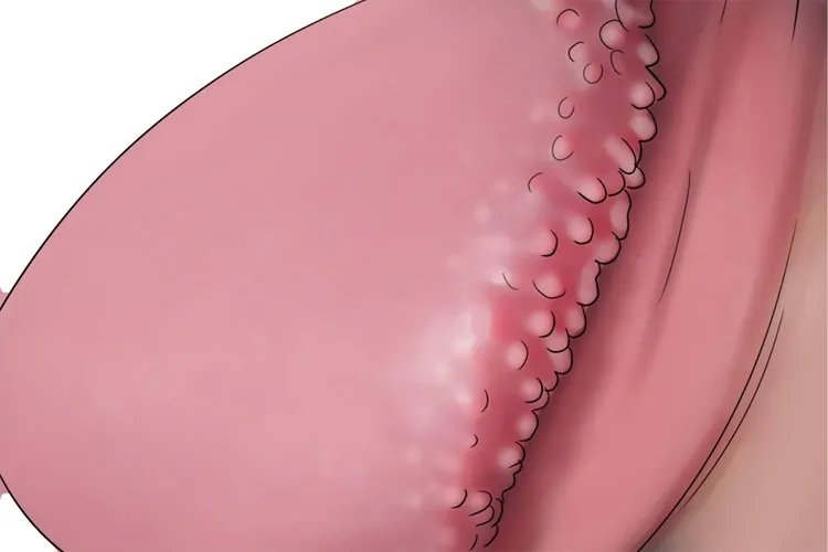 珍珠疹图片清晰