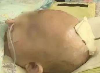 女婴被砸涉案人已经被确定了吗？