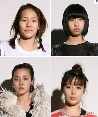2ne1成员整容前的照片