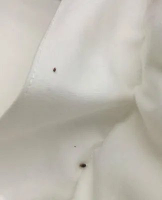 酒店床上十几只臭虫 在身上爬来爬去又叮又咬