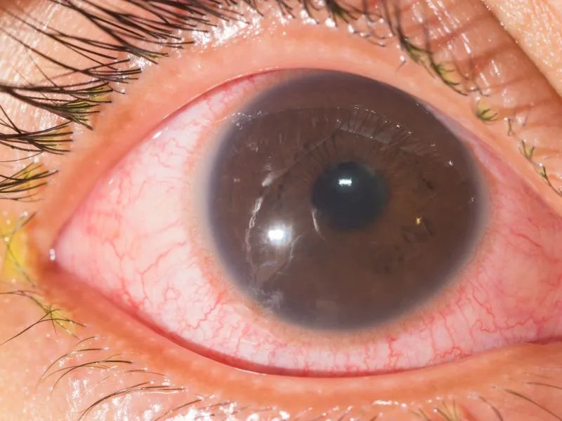 催泪瓦斯的用途