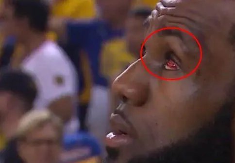 格林打到詹姆斯是什么原因？