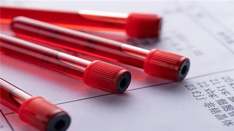 血浆和血液的区别