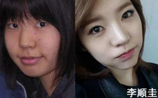 少女时代整容前后照片对比 少女时代为什么叫女帝