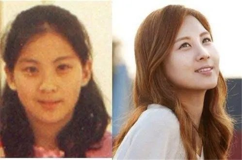 少女时代整容前后照片对比 少女时代为什么叫女帝