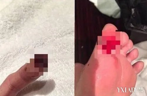 陈乔恩淤血照吓坏粉丝“傻大妞”果然名不虚传