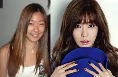 少女时代整容前后照片对比 少女时代为什么叫女帝