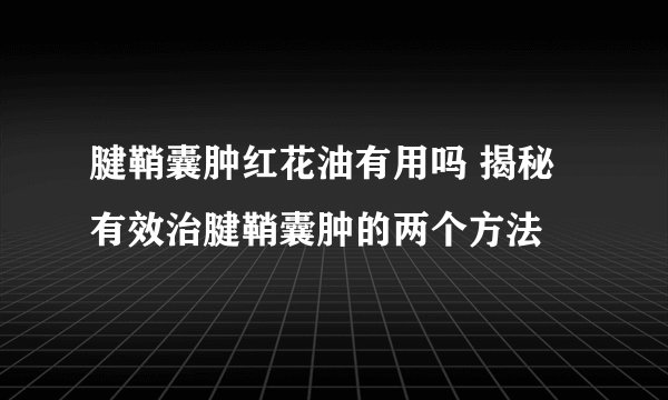 腱鞘囊肿红花油有用吗 揭秘有效治腱鞘囊肿的两个方法