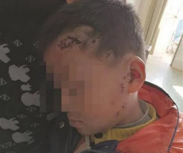 男孩被二哈扑咬是怎么回事？