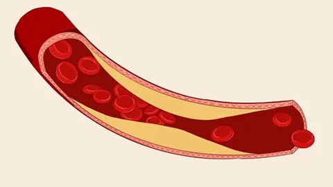 川芎嗪的功效与作用