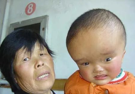 大头娃娃事件重演，问题奶粉再次出现，屡禁不止的原因是什么