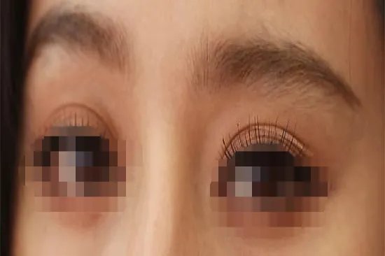 双眼皮有几种眼型图片