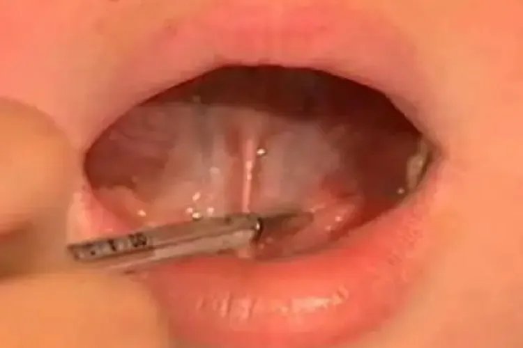 体温计怎么使用及看法图片