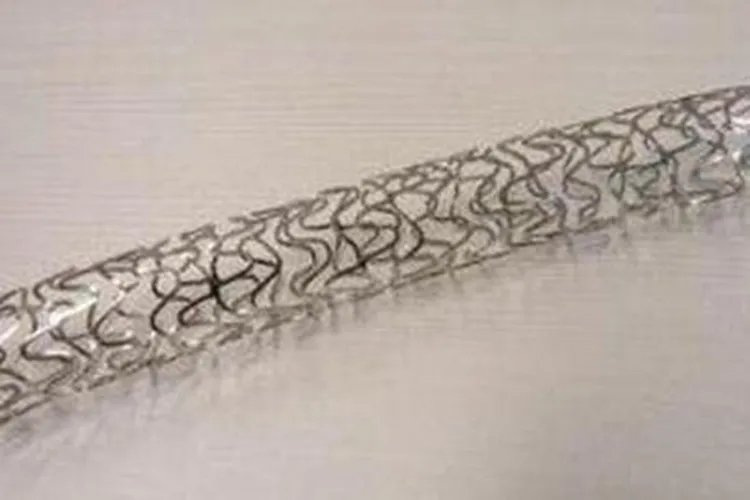 颈动脉支架图片