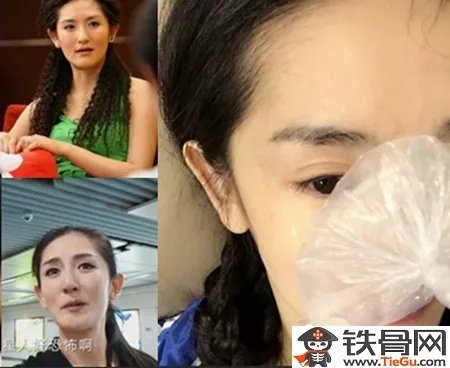 谢娜没带胸罩是哪一期 谢娜没整容前照片曝光