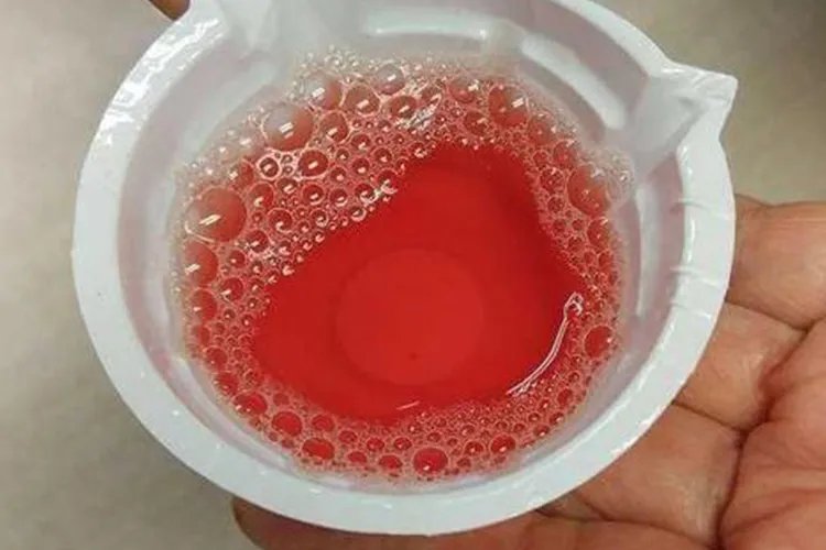 肾功能不好会出现什么样的状况