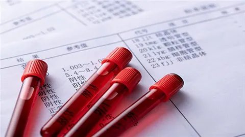 血浆和血液的区别