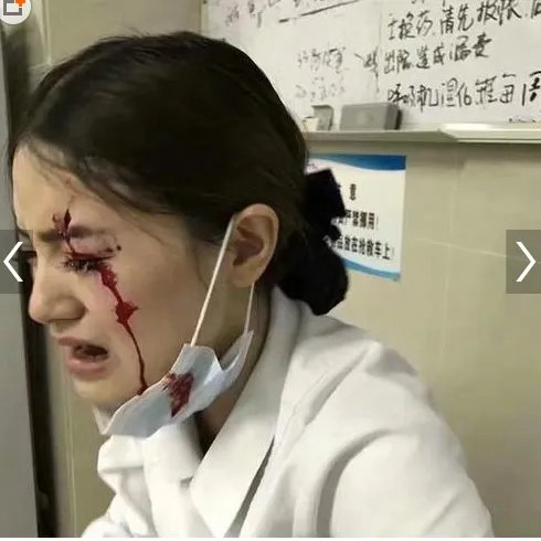 患者家属撞伤护士 受伤护士仍在进一步观察治疗当中