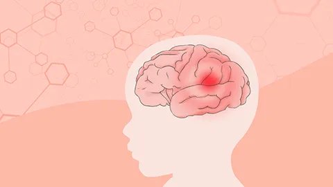 脑出血有什么症状