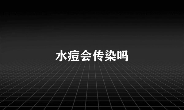 水痘会传染吗