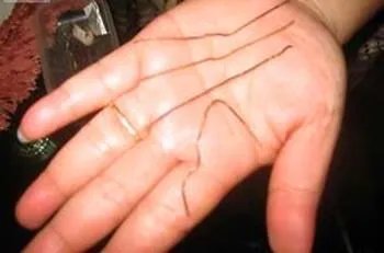 人称外星物种钢丝女努西达身体长钢丝图片 特异功能人的真实事件