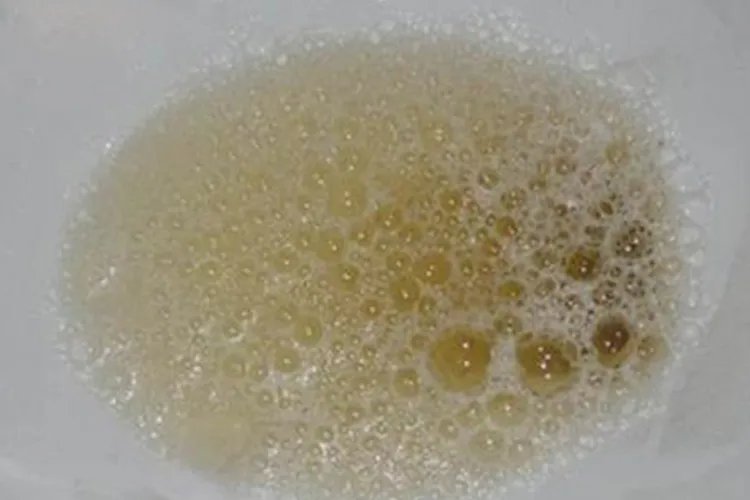 肾功能不好会出现什么样的状况