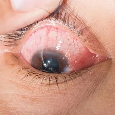 裂隙灯检查需要多少钱