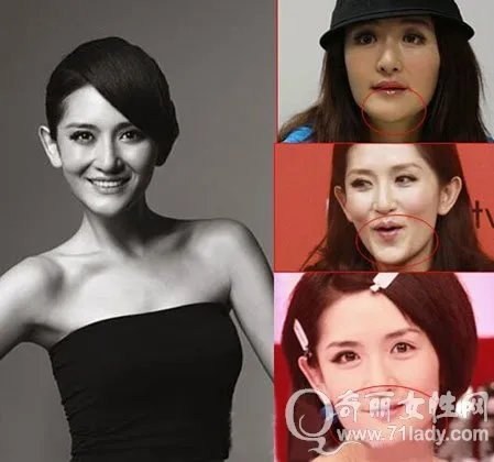 谢娜没带胸罩是哪一期 谢娜没整容前照片曝光