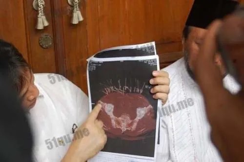 人称外星物种钢丝女努西达身体长钢丝图片 特异功能人的真实事件