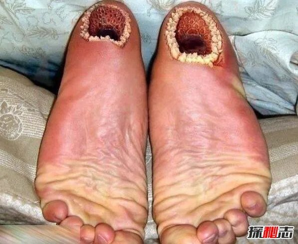 超恶心的空手指是什么,将七鳃鳗嘴巴P在手指上的恶搞图片