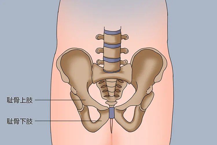 孕妇耻骨在哪个位置的图片