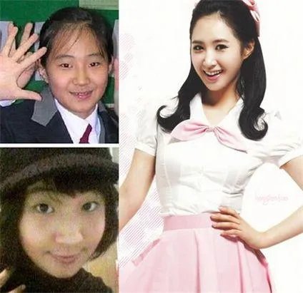少女时代整容前后照片对比 少女时代为什么叫女帝